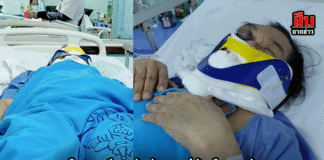 เดือด! ชาวศรีสะเกษร้องผู้การฯ ถูกทำร้ายเลือดอาบหน้า แต่คดีนิ่งสนิท — วอนเร่งคืนความเป็นธรรม อย่าปล่อยให้ “เงียบหาย”