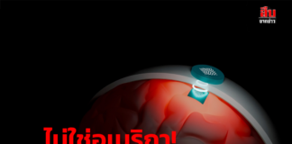ไม่ใช่อเมริกา! ประเทศแรกอนุมัติขาย ‘อุปกรณ์ฝังสมอง’ เชื่อมคอมฯเครื่องแรกของโลก